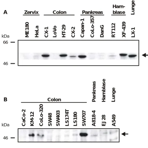 Abbildung 1: Western-Analyse der p53-Proteinmenge in Tumorzelllinien verschiedener Gewebe  Gezeigt ist der Nachweis von p53-Protein in Kernextrakten aus insgesamt zwei Zervix-, zwölf Colon-,  vier Pankreas-, drei Harnblasen- und zwei Lungenkarzinomzelllini