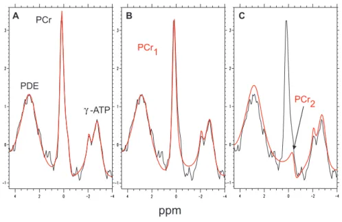 Abb. 3.13: Scheinbare Aufspaltung der PCr-Resonanz beim LPSVD-Fit. A: Rohdaten