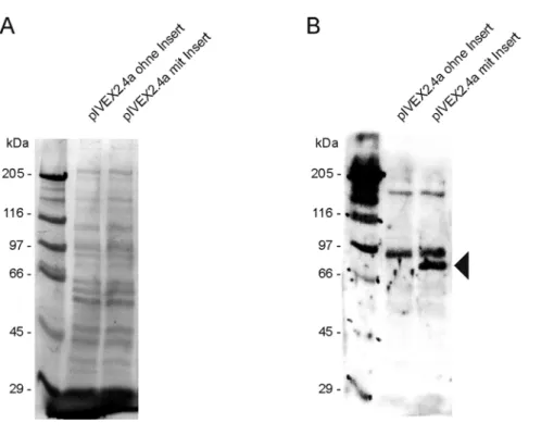 Abb. 4.28 Nachweis der in vitro Transkription und Translation von 26C/C9/2 cDNA in Vektor pIVEX2.4a.