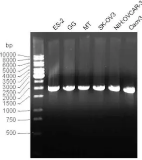 Abb. 4.23 Elektrophoretische Auftrennung der PCR-Produkte von 26C/C9/2. Die PCR diente der Überprüfung der ermittelten Sequenz.
