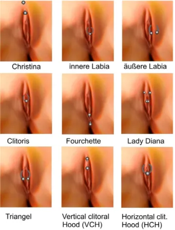 Abb. 5  Diverse Formen weiblicher Genital-Piercings (Kasten 2012, mit freundlicher  Genehmigung der OmniMed Verlagsgesellschaft Hamburg)