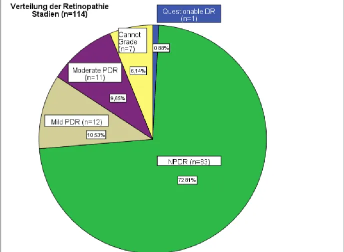 Abbildung 30: Kreisdiagramm zur Verteilung der Retinopathiestadien; von den 114 Patienten lag bei 83 (73 %) eine  NPDR (nicht-proliferative diabetische Retinopathie) vor, eine milde PDR (proliferative diabetische Retinopathie) bei  12 Patienten (11 %) und 