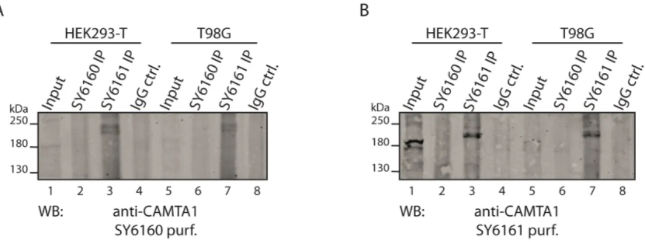 Figure 2.7: Immunoprecipitation of endogenous CAMTA1 from HEK293-T and T98G cells via  the generated antibodies