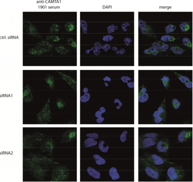 Figure 2.9: Immunofluorescence of endogenous and knocked down CAMTA1 using the 1901  antibody