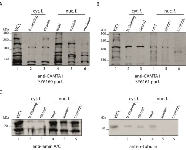 Figure 2.13: Subcellular fractionation of HeLa-S3 suspension culture cells to detect endogenous  CAMTA1 by the generated antibodies