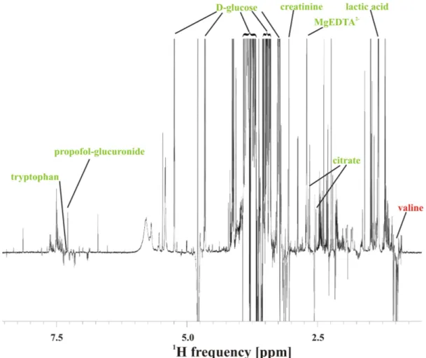 Figure 5.1: Exemplary 1D 1 H NMR subtraction spectrum of plasma specimens col- col-lected 24 h after cardiac surgery