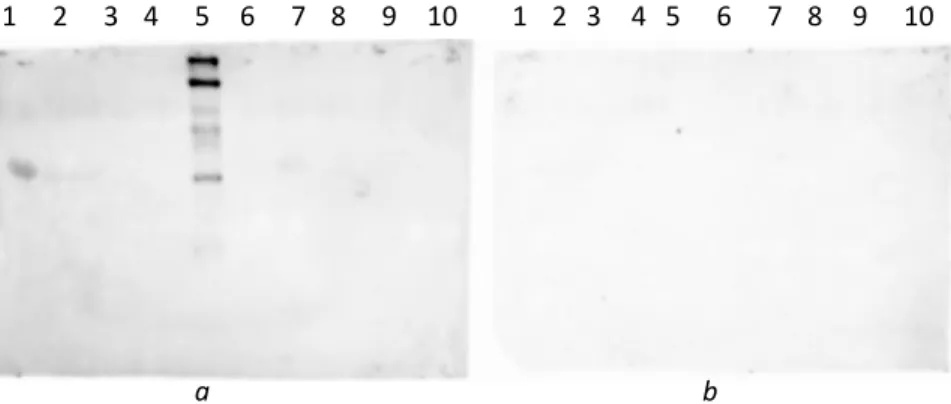 Figure 2.9:  α-s1-Casein (8 µg in lane  1, 1.5 µg in lane 7), dephosphorylated  α-s1-casein (2 and 8), BSA (3 and 9),  the  polyhistidine tagged protein (4 and 10), prestained molecular weight marker (5), non-prestained molecular weight marker  (6), were b