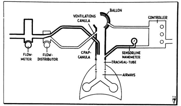 Fig. l a. Principal structure of the apparatus. Parts needed for CPAP in heavy print.