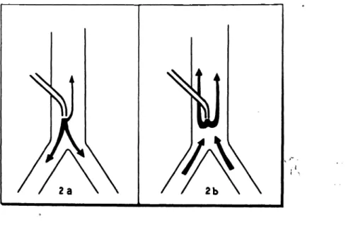 Fig. 2 a, 2b. Flow distribution during CPAP assisted Ventilation a) at Inspiration, b) at exspiration.