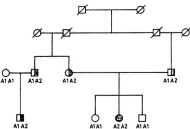 Fig. 3. Pedigree of a family with the Αρα LI polymorphism within intron 3 of the LDL receptor gene,