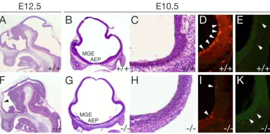 Figure 4: Neuroanatomy and analysis of cell proliferation and apoptosis of lrp2 -deficient embryos