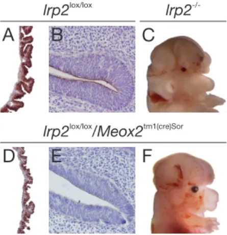 Figure 6: Forebrain abnormalities and LRP2 expression pattern in E14.5 embryos with conditional lrp2 gene inactivation