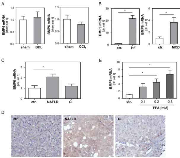 Figure 1 BMP6 expression in non-alcoholic fatty liver disease (NAFLD). (A) Hepatic mRNA expression of BMP6 in different murine models of chronic liver injury