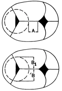 Figure 4. Determinations for assessment of cup position.