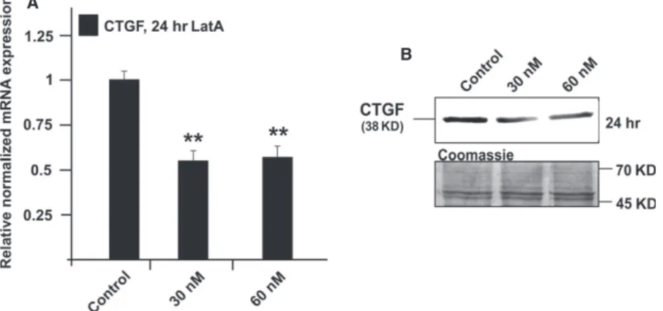 Fig. 3 Analysis of CTGF expression in HTM cells after treatment with 30 or 60 nM latrunculin A for 24 hrs
