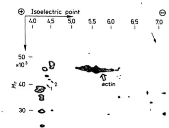 Fig. 2. Two-dimensional gel electrophoretogram of erythrocyte membrane proteins obtained from a patient with pseudo^