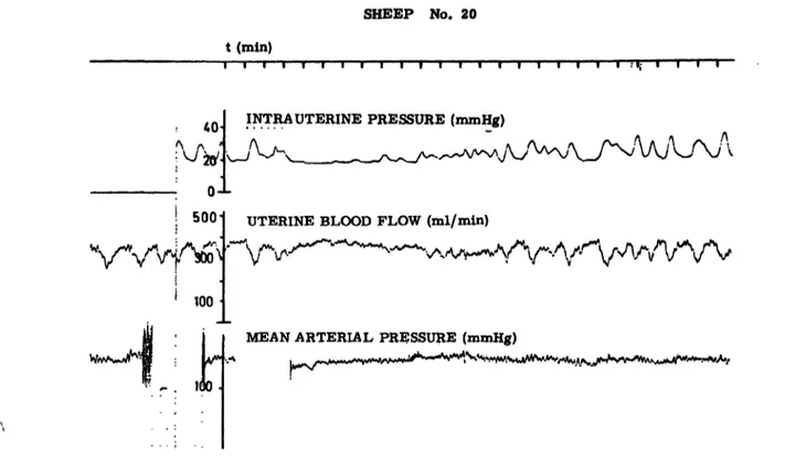 Fig. 1. Simultaneous recording of intrauterine pressure, uterine blood flow and mean arterial pressure in a pregnant sheep