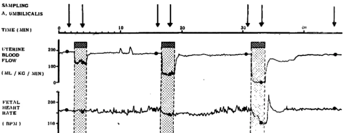 Fig. 3. Semischematic diagram showingdata aquisition during repetitive acute flowmeter controlled reduction of uterine blood flow.