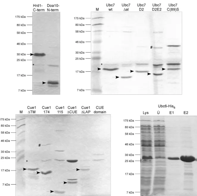 Abbildung 4: Aufreinigung verschiedener ERAD-Komponenten nach heterologer Expression  in  Escherichia coli