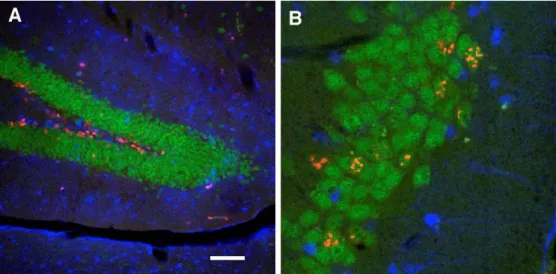 Abb. 2: Neue Nervenzellen im erwachsenen Gyrus dentatus der Maus. (A) Sich teilen- teilen-den Zellen in der subgranulären Zone wurteilen-den mit Bromodesoxyuridin (BrdU; rot) sichtbar gemacht