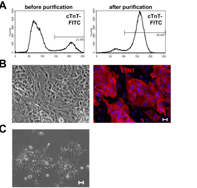 Fig 3. Purification of iPS cell-derived cardiomyocytes with metabolic selection. A: Percentage of cTnT-positive cells in suspension culture before and after metabolic selection with lactate medium; B: Plated cells from a suspension culture treated with met