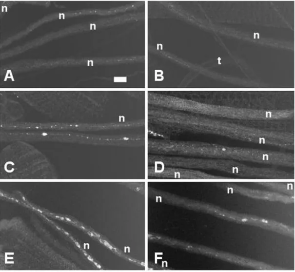 Abbildung 4: Interaktion von Gl 1  mit mutierten Versionen der Motorproteine Kinesin und  zytoplasmatisches Dynein