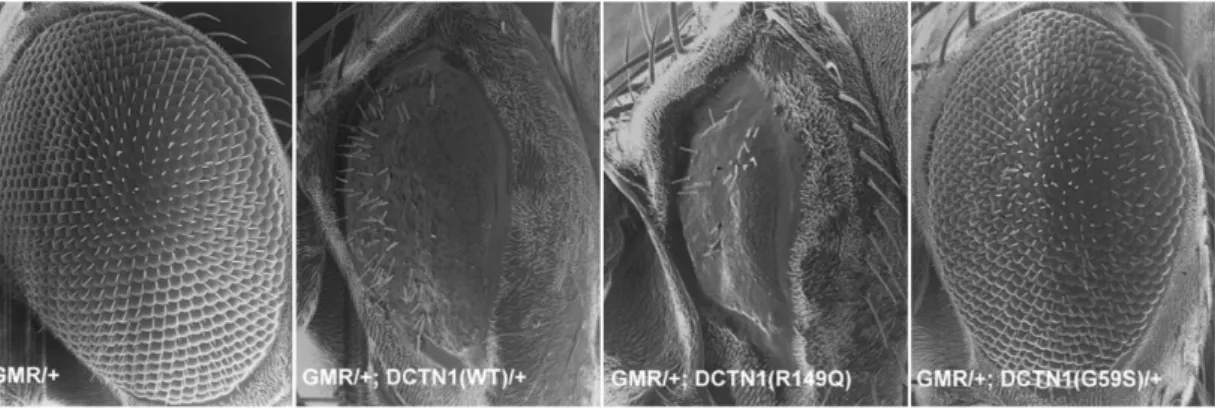 Abbildung 6: Rasterelektronenmikroskopische Aufnahmen der augenspezifischen  Überexpression der DCTN1-Konstrukte