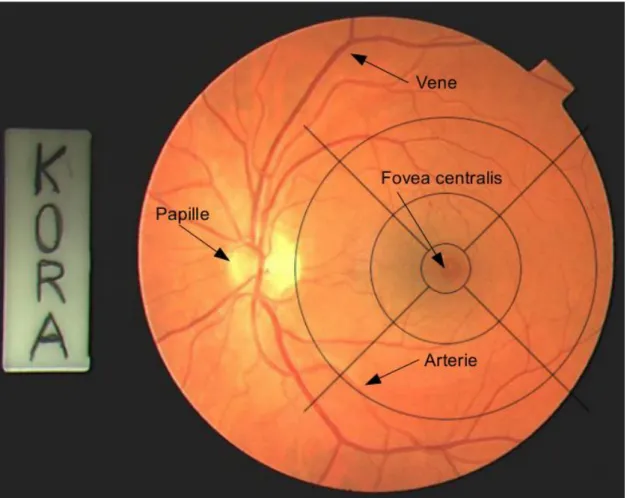 Abbildung  6:  Zentrales  Farbfundusfoto  des  linken  Auges  mit  digital  implementiertem,  adaptiertem  Grid