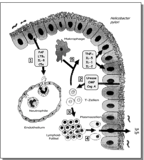 Abbildung 1: Schematische Darstellung der lokalen Immunantwort bei H. pylori-assoziierter Gastritis  (modifiziert nach CRABTREE, 1996)