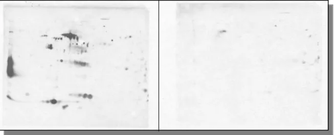 Abbildung 5 zeigt im Vergleich die Immunoblots von zwei verschiedenen Patienten. 