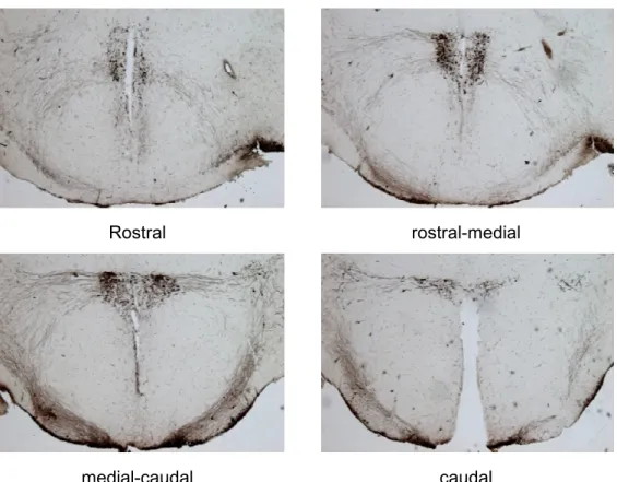 Figure  18:  Representative  images  of  mouse  brain  slices  stained  for  AVP  in  the  PVN