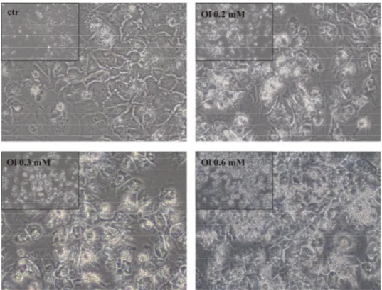 Figure 3.3 HUH7 cells stimulated with oleate 0.2 mM, 0.3 mM, 0.6 mM, respectively (magnification  40x)