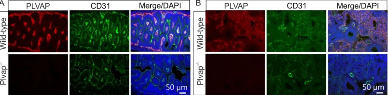 Figure 8: Generation of mutant Plvap-deficient mice. A and B, Double immunohistochemistry with antibodies  against PLVAP and the endothelial cell marker CD31 shows the presence of PLVAP in capillary endothelial cells  of small intestine (A) or lung (B) in 