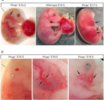 Figure 9: Phenotype of Plvap-deficient embryos in C57BL/6N background. A, E 16.5 Plvap  -/-  embryo with a  pronounced subcutaneous edema that  extends  from  the neck  to  the  lower  back  ( white  arrow)