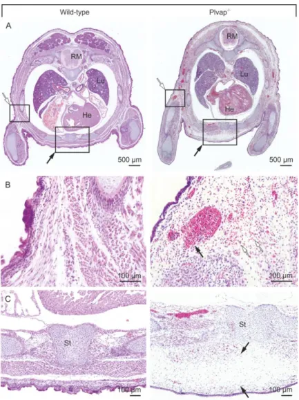 Figure  10:  Histological  characterization  of  Plvap-deficient  embryos  in  C57BL/6N  background