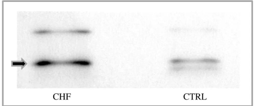 Abbildung  4.2a  Validierung  mit  Western  Blot  für  Tyrosine  3-Monooxygenase/ 