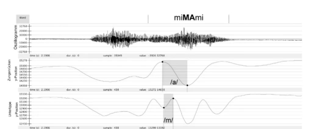 Abbildung 1.4: Oszillogramm (oben) und vertikale Positionskurven für Zungenrücken (Mitte) und Unterlippe (unten) in der Zielsilbe [ma] in der katalanischen Äußerung &lt;La MiMAmi&gt;.