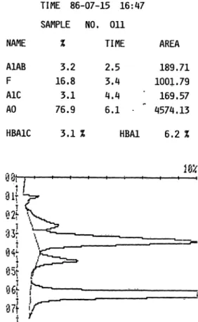 Fig. 1. Printout of sample with high HbF.