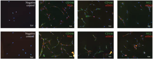Figure 5: Coexpression of pericyte markers on MSCs after direct coculture with EPCs for 7 days in IMDM-FCS (top row) or IMDM-PL (bottom row)