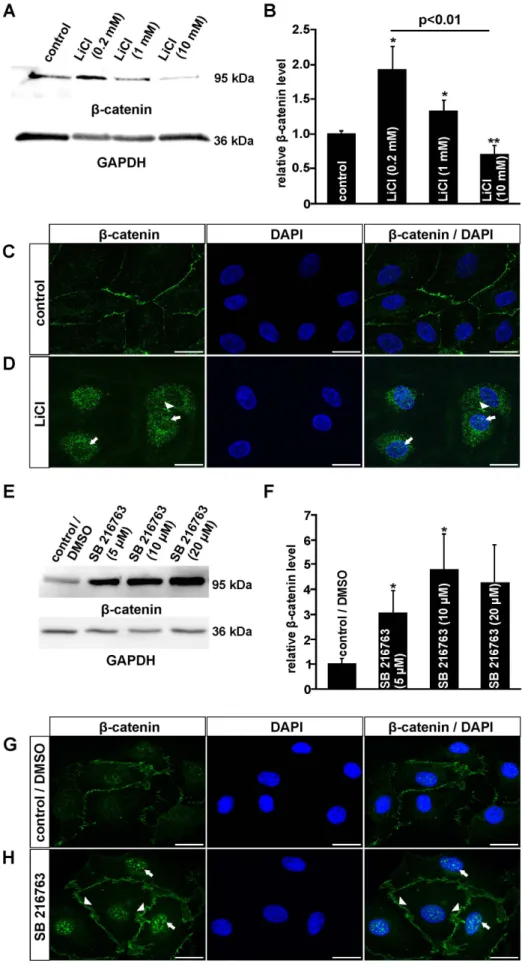 Figure 1. LiCl and SB 216763 activate the canonical Wnt/b-catenin pathway in HDMEC. A, B, E, F