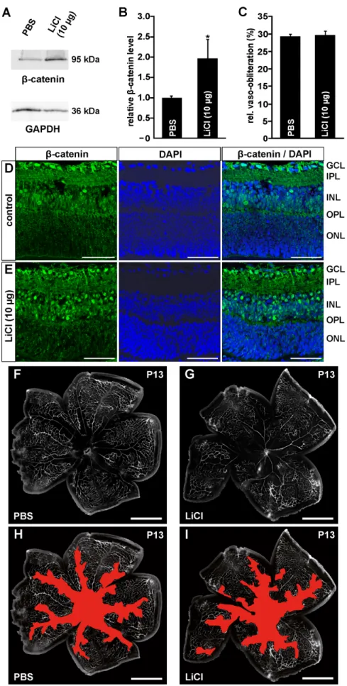 Figure 6. Intravitreal LiCl injections activate the Wnt/b-catenin pathway following OIR, but have no influence on vessel regrowth into vaso-obliterated areas