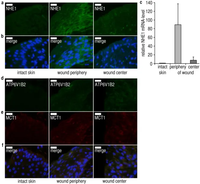 Figure 4: Expression and localization of pH e -regulatory proton transporters in chronic wounds