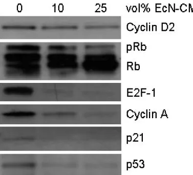 Abb. 2: Expression von Zellzyklusregulatoren in stimulierten PBT unter 0, 10 und 25%igen  Konzentrationen von EcN-CM (Western Blot)