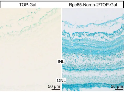 Figure 21: Wnt pathway reporter mice (TOPGAL): β-galactosidase staining 