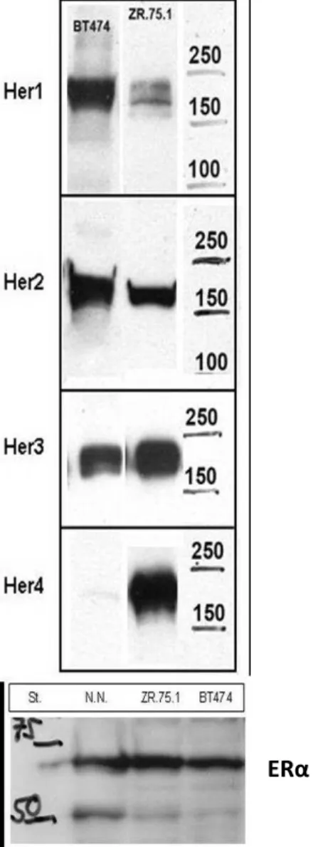 Abb. 9: Western-Blot der Brustkrebszelllinien BT 474 und ZR-75-1 zum Nachweis von ErbB1 (Her1) bis ErbB4 (Her4) und  ERα (Estrogenrezeptor alpha)