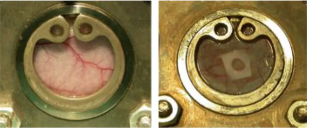 Abbildung 2.6: Transparente Titanrückenhautkammer vor und nach Implantation in 4-facher Vergrößerung