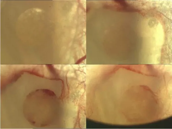 Abbildung  3.8:  Intravitalmikroskopische  Aufnahme  eines  eintägig  vorkultivierten,  mit  mesenchymalen  Stammzellen besetzten Konstrukts (MSC 1) in der Rückenhautkammer an den Versuchstagen 1, 7, 10 und 14  (von links oben nach rechts unten)