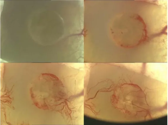 Abbildung  3.9:  Intravitalmikroskopische  Aufnahme  eines  vierzehntägig  vorkultivierten,  mit    mesenchymalen  Stammzellen besetzten Konstrukts (MSC 14) in der Rückenhautkammer an den Versuchstagen 1, 7, 10 und 14  (von links oben nach rechts unten)