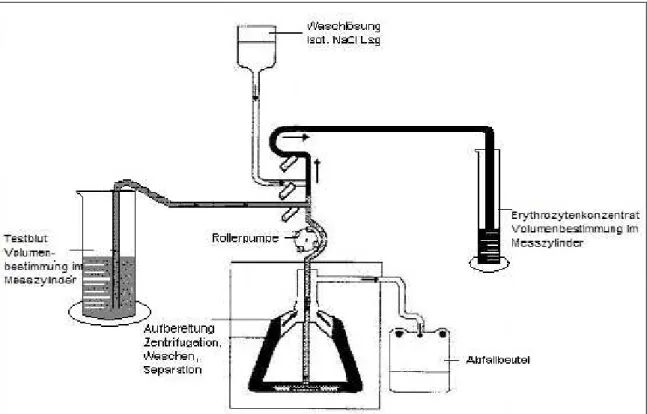 Abb. 15: Versuchsaufbau am Beispiel von Electa (unter Ausschluss des Reservoirs und   Produktbeutels) 