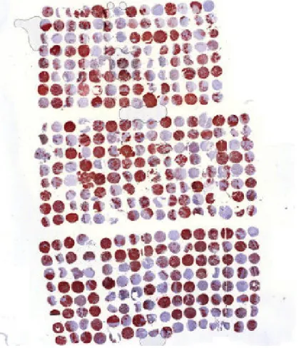 Abbildung 3.7. Erstellung des Tissue Microarrays 